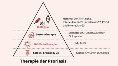 04-psoriasis-therapie