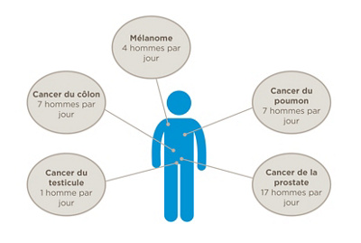 cancer chez l'homme