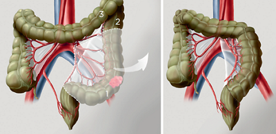 Abbildung des S-Darms, Dickdarms und Querdarms