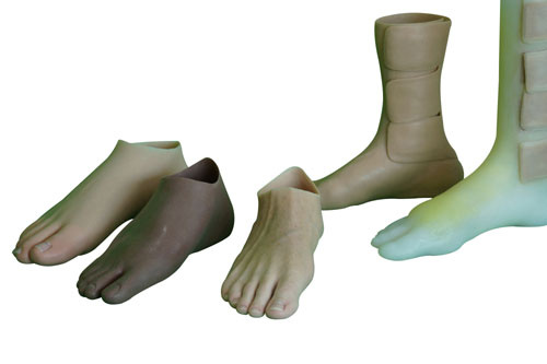 Partial foot amputation – Atlantic Prosthetic Orthotic Services Ltd