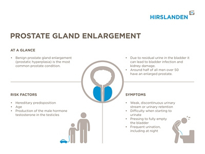 Prostate gland enlargement