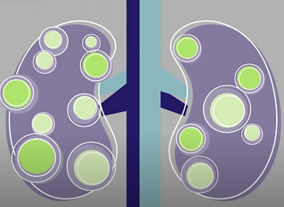 Gesundheitsmagazin CheckUp