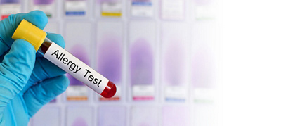 Allergy testing explained