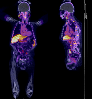 Von der Gen-Expression zum Bild.