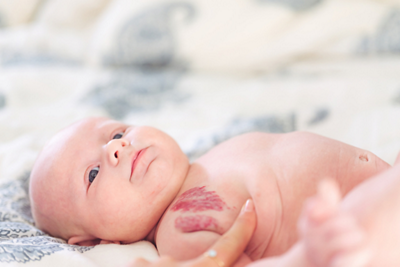 Birthmarks- 1152 x 768 - 1