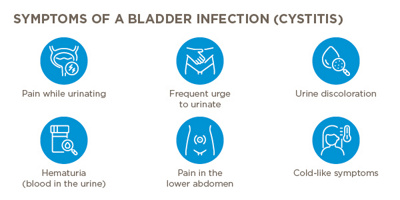 Illustration of symptoms of cystitis