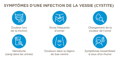 Illustration Symptômes de la cystite