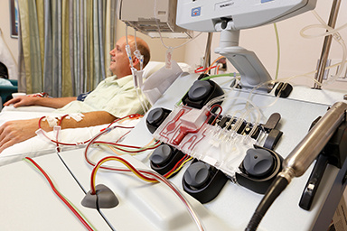 Patient im Bett während einer Blutstammzellapherese