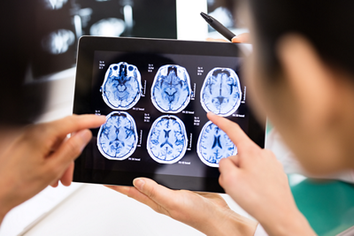 Brain-Surgery_02