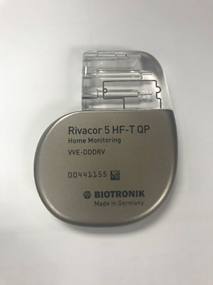 Cardioverter-Defibrillator2