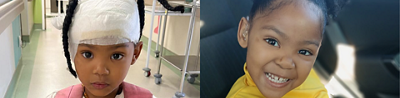 Cochlear implant gives a child the gift of sound