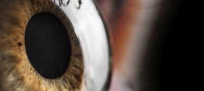 Cornea transplant gives high school girl her vision back