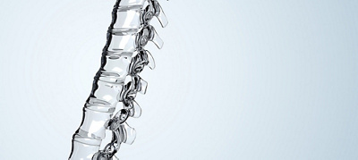 Dr Petrus Stone completes 200 DLIF procedures