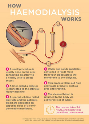 Dialysis-and-kidney-infographic-part-2