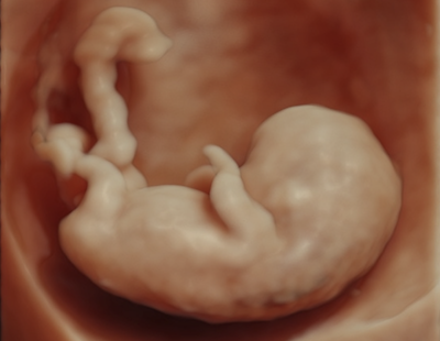 Echographie_Gyneco-1