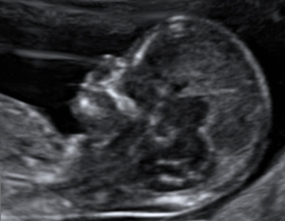 Echographie_Gyneco_1