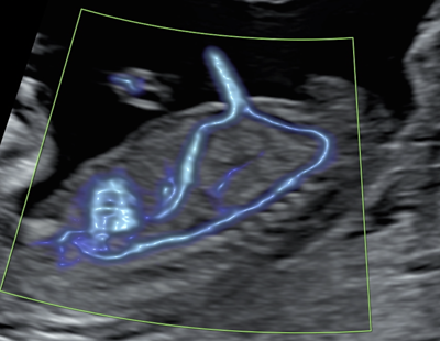 Echographie_Gyneco_2