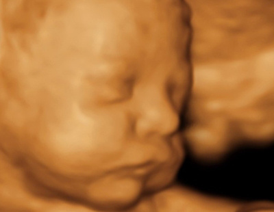 Echographie_Gyneco_4-1