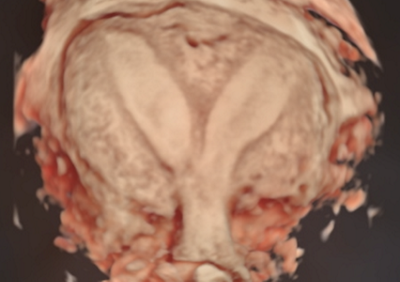 Echographie_pelvienne_3