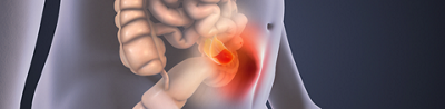 Robotic surgery for hernias: A modern treatment approach