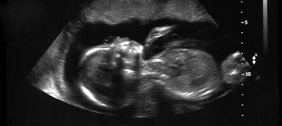 Foetal testing in the future