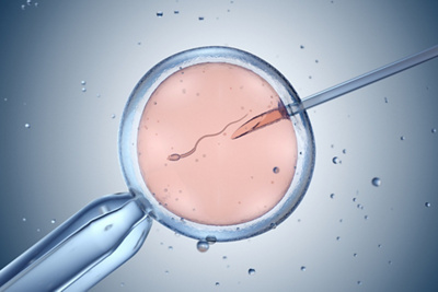 In-vitro