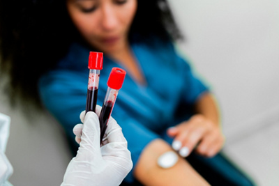 Blood test vs Skin prick for allergies [INFOGRAPHIC]