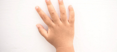 Groundbreaking surgeries performed on two young patients with hand deformities