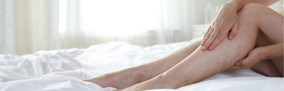 Sollte man Beschwerden bei Krampfadern abklären lassen?