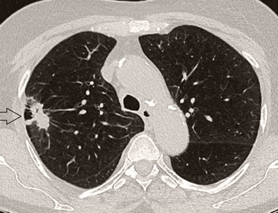 Hirslanden-Computertomografie-ohne-hohe-Strahlenbelastung-1