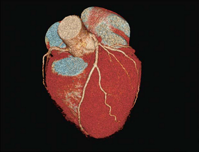 Hirslanden-Computertomografie-ohne-hohe-Strahlenbelastung-2