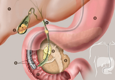 Hirslanden-Erhöhte-Leberwerte-und-Gelbsucht-2