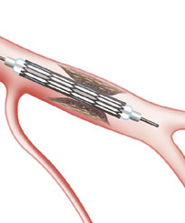 Hirslanden-Herzinfarkt-ein-Wettlauf-mit-der-Zeit-3