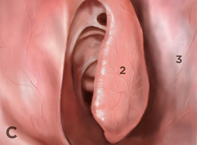 Hirslanden-Konservative-und-chirurgische-Behandlung-der-oberen-Atemwege-3