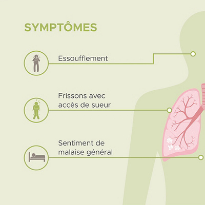 Visualisation des symptômes d'une pneumonie