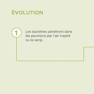 Verlauf einer Lungenentündung in 4 Schritten