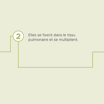 Hirslanden-urgence-pulmonaire-pneumonie-07