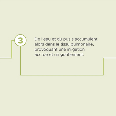 Hirslanden-urgence-pulmonaire-pneumonie-09