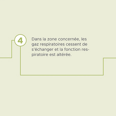 Hirslanden-urgence-pulmonaire-pneumonie-11