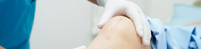 5 things to know about hip replacement