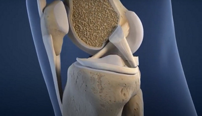 Hüftgelenk bei einem Skelett