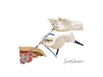 Röntgenbild der Wirbelsäule - Wirbelsäulenzentrum Zürich