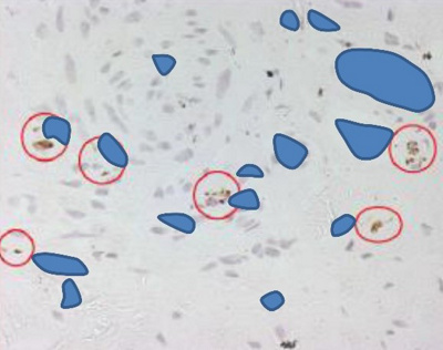 Lagebezug von neu gebildeten Nerven 