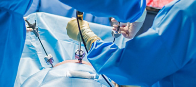 First Formal Laparoscopic Hepatectomy Performed at Mediclinic Panorama