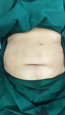 MAIN Bariatric surgeries 1