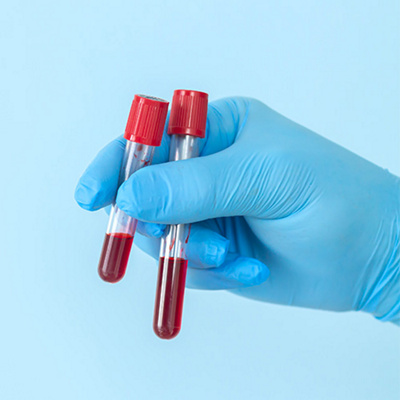 MAIR-Haematology-500x500