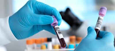Blood tests for women