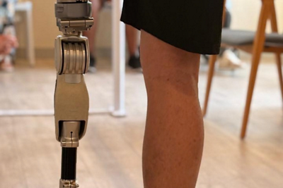 MC-Osseointegration- 1152 x 768 - 1
