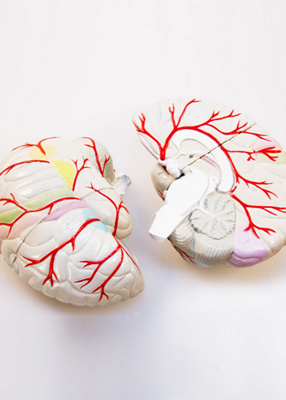 MCIT-cerebral-stroke