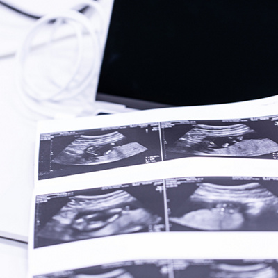 MCME-2nd-Trimester-Fetal-Anomaly-Scan